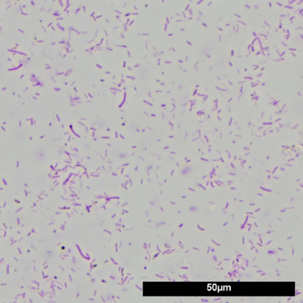 JBL Denitrol Aquarium Beneficial Bacteria: Rapid Pollutant Breakdown for Healthy Fish - Image 4